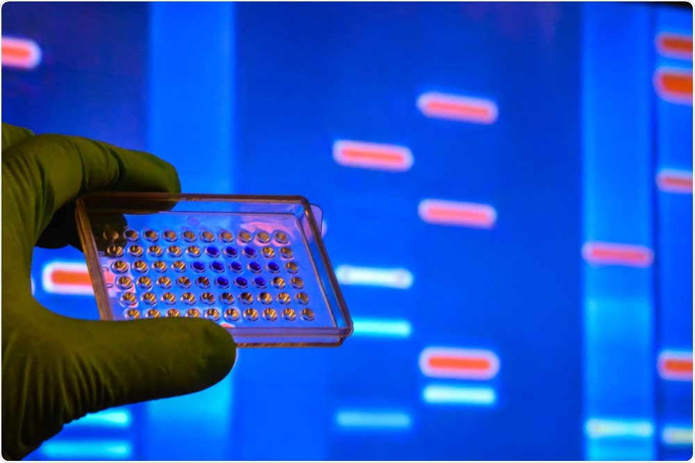 Study: Genomic epidemiology reveals transmission patterns and dynamics of SARS-CoV-2 in Aotearoa New Zealand. Image Credit: Sergei Drozd / Shutterstock