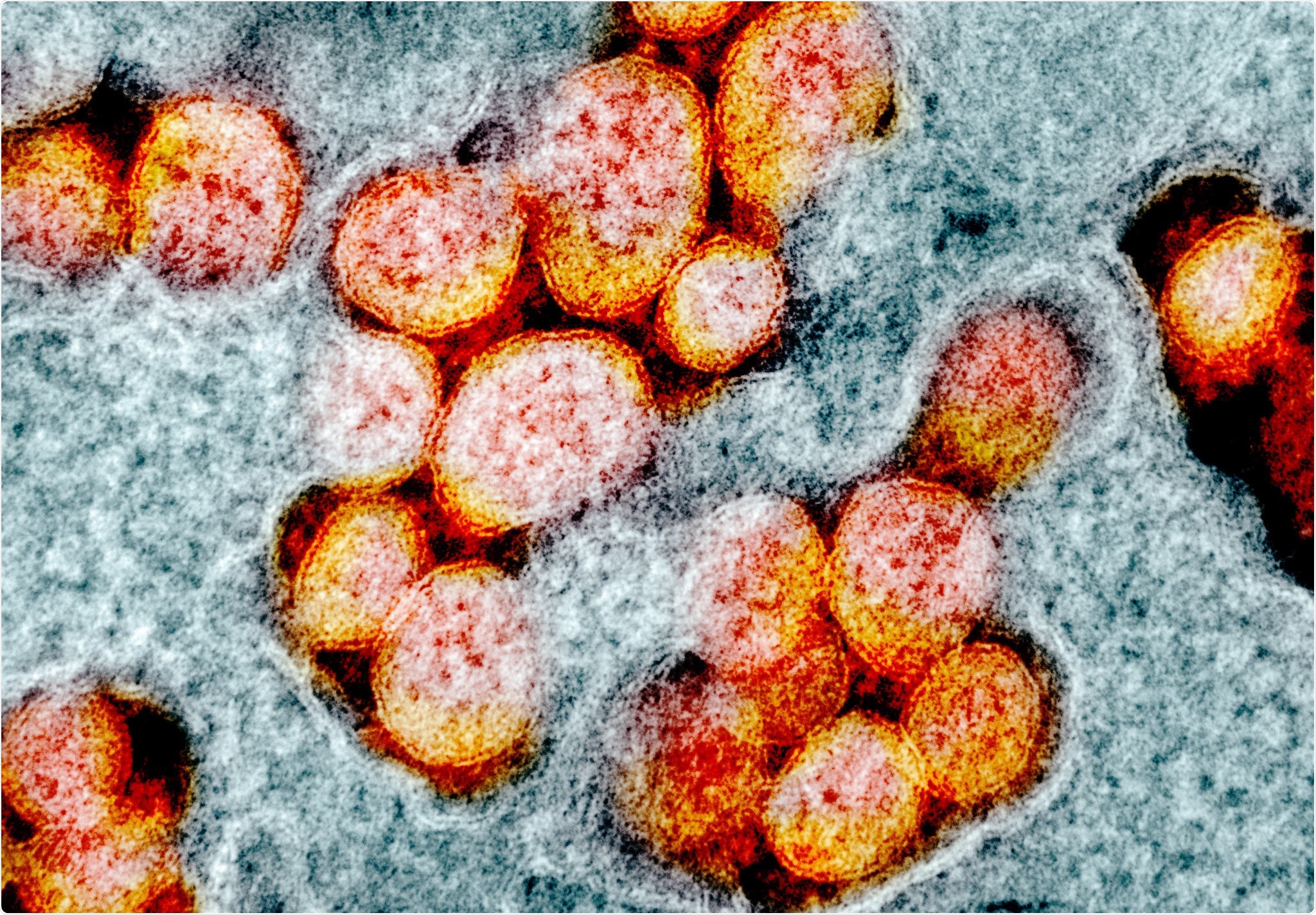 Study: Occurrence and transmission potential of asymptomatic and presymptomatic SARS-CoV-2 infections: A living systematic review and meta-analysis