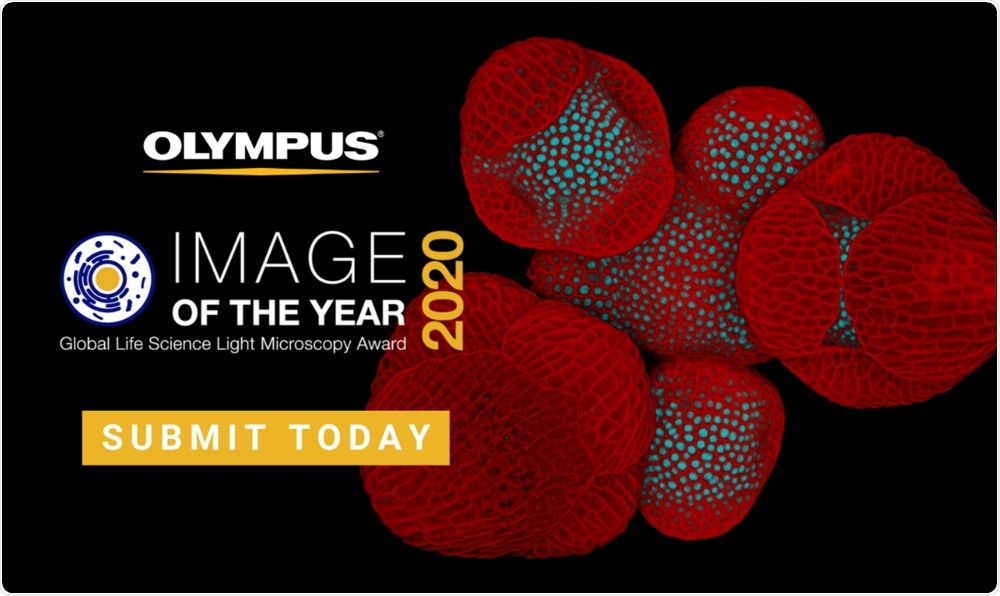 The art of science: Olympus launches second global image of the year award The art of science: Olympus launches second global image of the year award