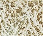 Risk Factors of Osteoporosis