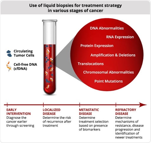 Liquid Biopsy