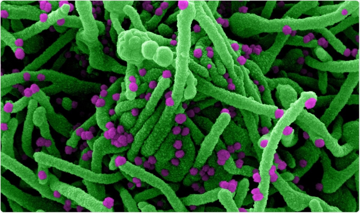 Study: Identification of existing pharmaceuticals and herbal medicines as inhibitors of SARS-CoV-2 infection. Image Credit: NIAID / Flickr