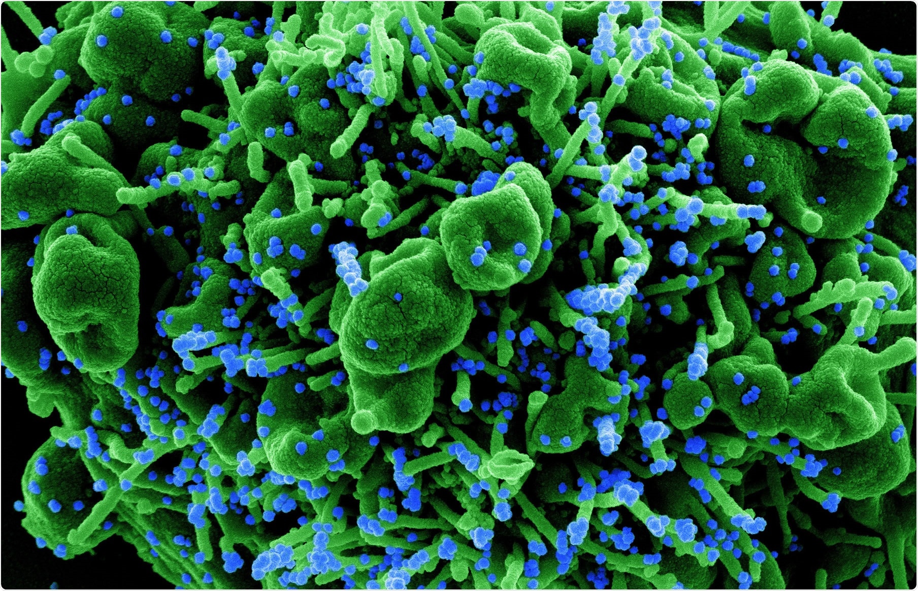 Study: Bispecific antibody prevents SARS-CoV-2 escape and protects mice from disease. Image Credit: NIAID