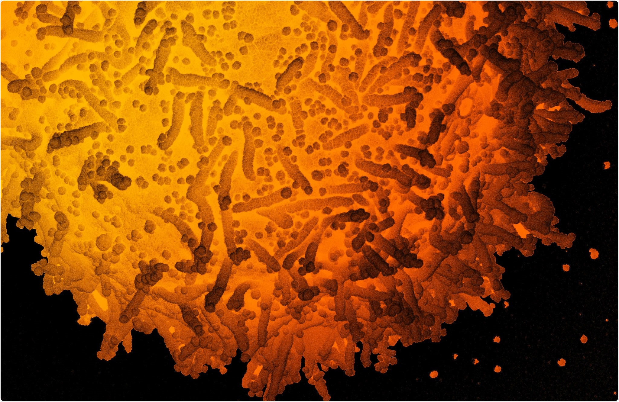 Study: Emergence and Evolution of a Prevalent New SARS-CoV-2 Variant in the United States. Image Credit: NIAID