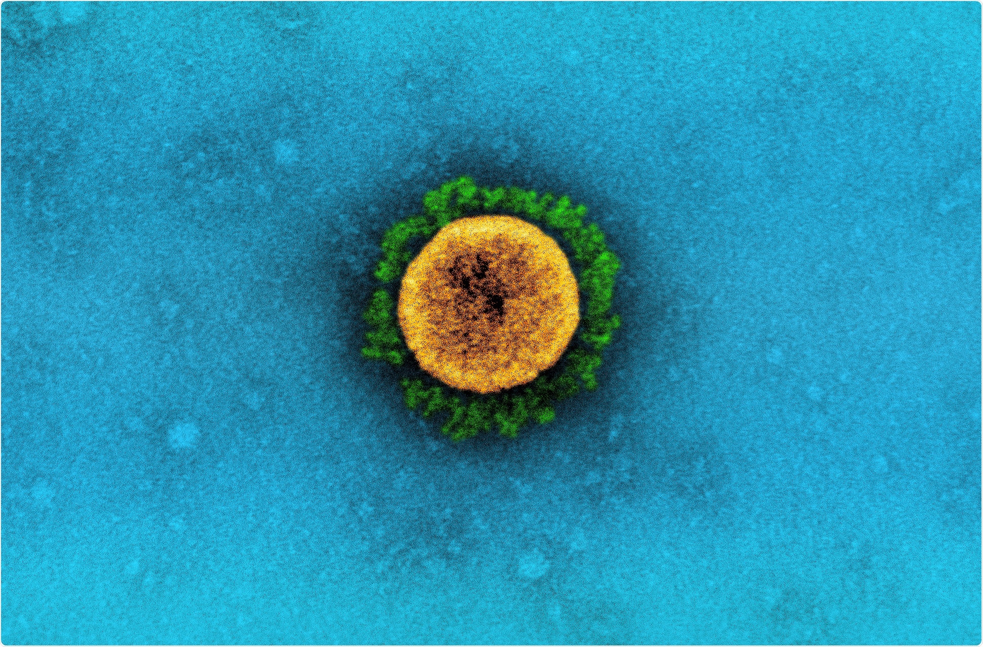 Study: Six-month sequelae of post-vaccination SARS-CoV-2 infection: a retrospective cohort study of 10,024 breakthrough infections. Image Credit: NIAID