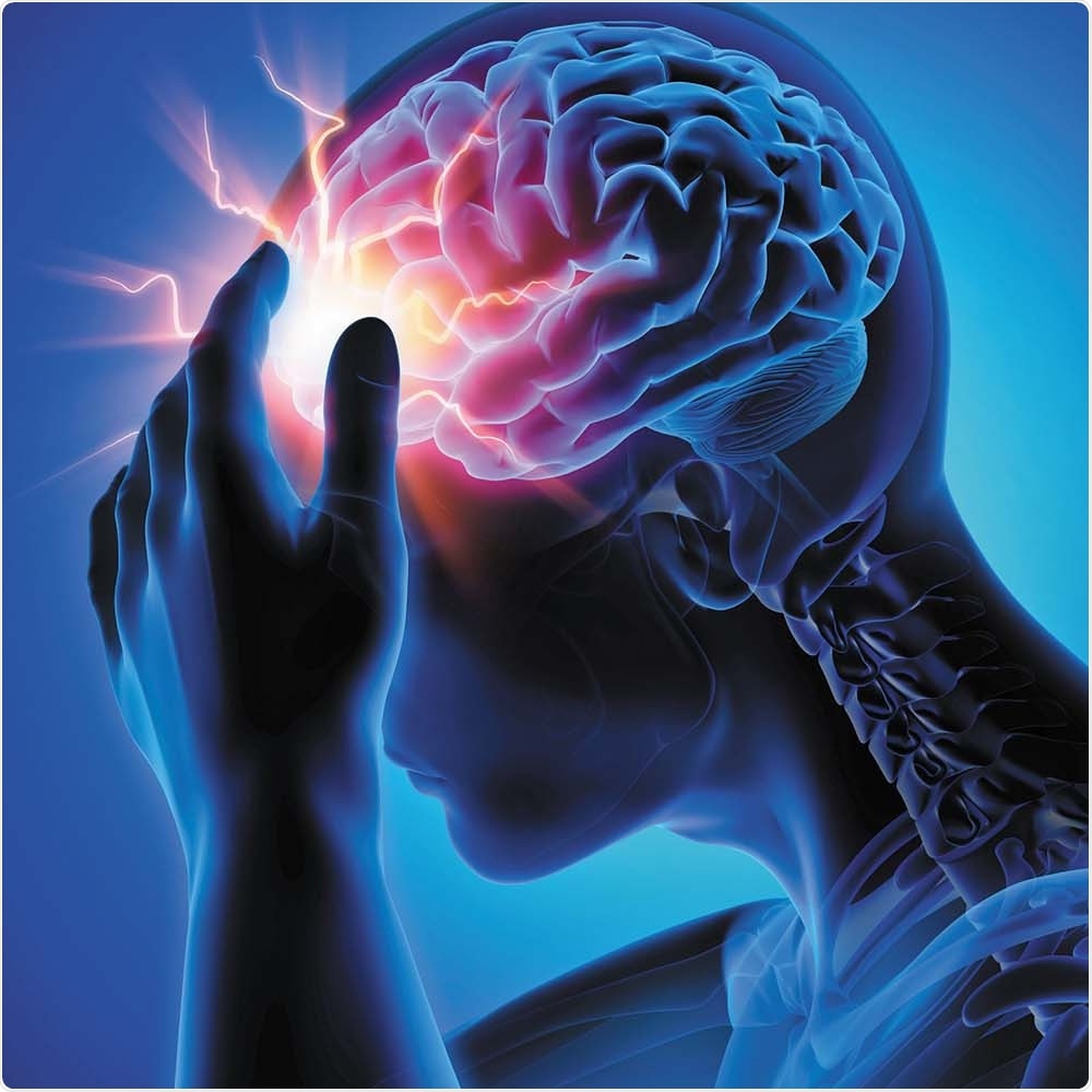 People with asymmetric brain arteries have a higher risk of developing aneurysms