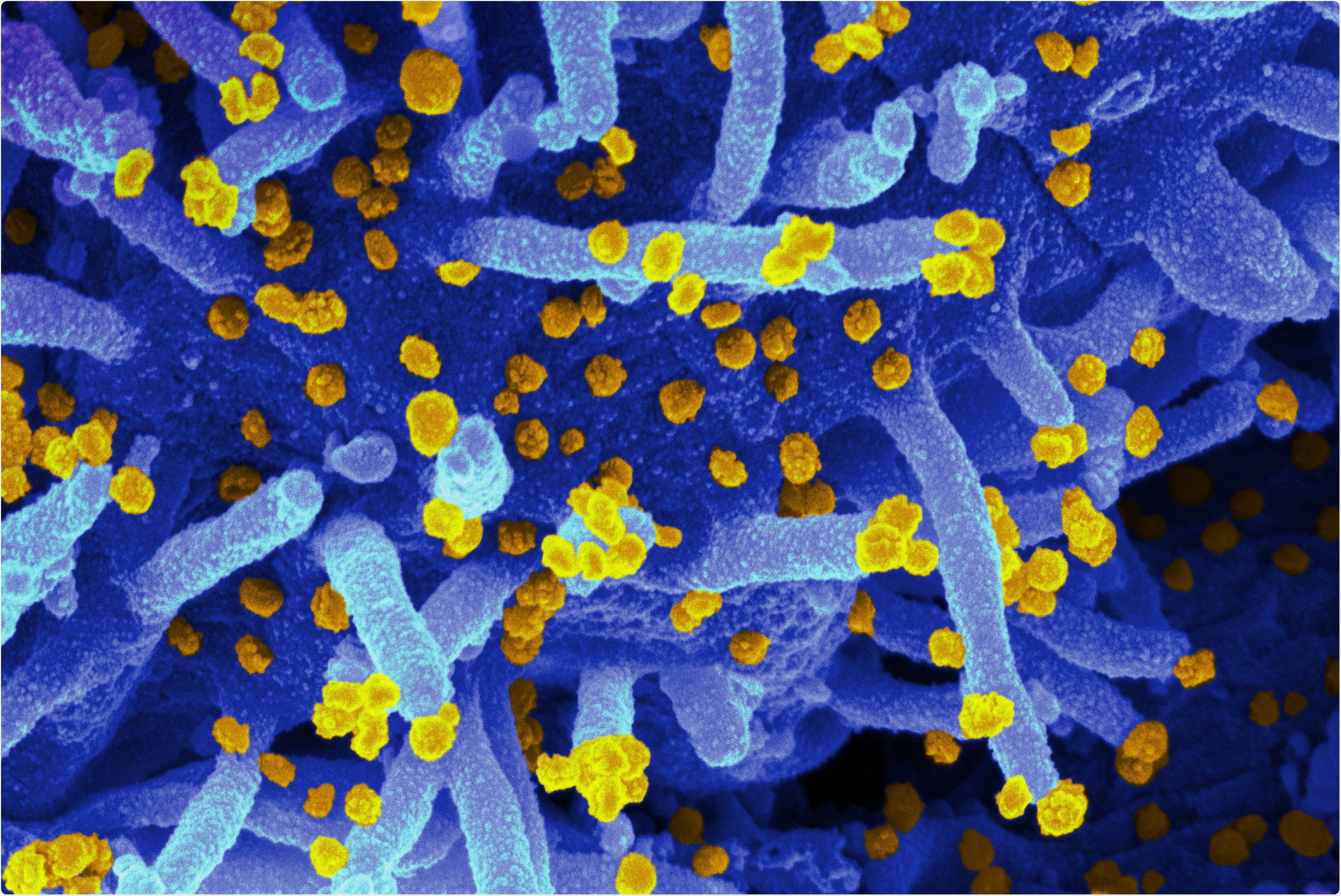 Study: Viral E Protein Neutralizes BET Protein-Mediated Post-Entry Antagonism of SARS-CoV-2. Image Credit: NIAID