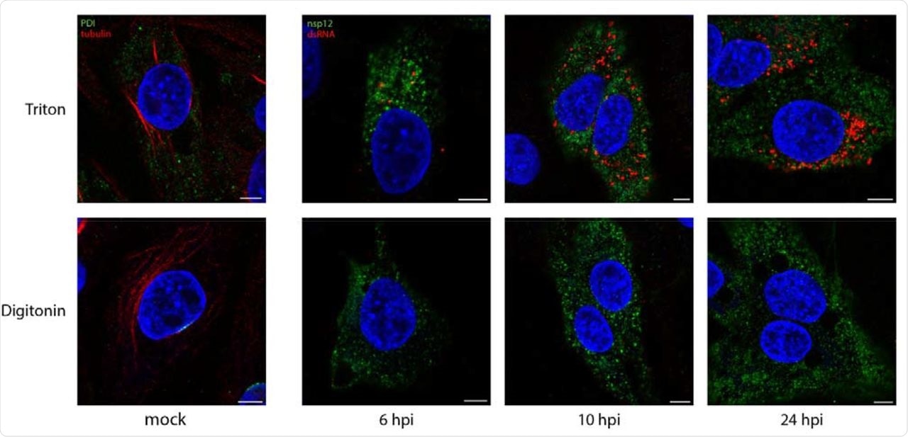 DsRNA is contained within a membrane-bound compartment whilst nsp12 is exposed to the cytoplasm. DF1 cells were infected with IBV and fixed at the indicated times post infection. Cells were permeabilized with either Triton X-100 (all membranes permeabilized; top row), or digitonin (plasma membrane permeabilized only; bottom row). Cells were labeled with dsRNA (red) and nsp12 (green), or for the mock control (first column), tubulin (red) and PDI (green). Nuclei are labeled blue with DAPI (blue). Scale bars represent 5 μm.