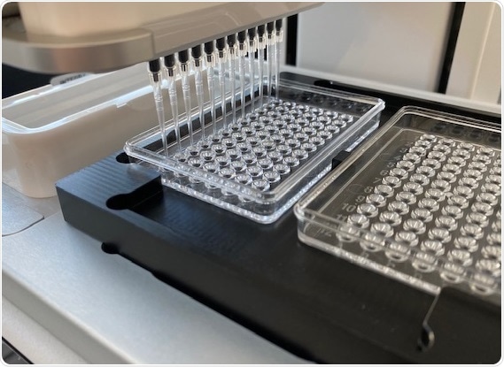 Automating the human leukocyte antigen (HLA) workflow