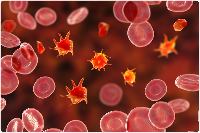 Bernard-Soulier syndrome Bernard-Soulier syndrome