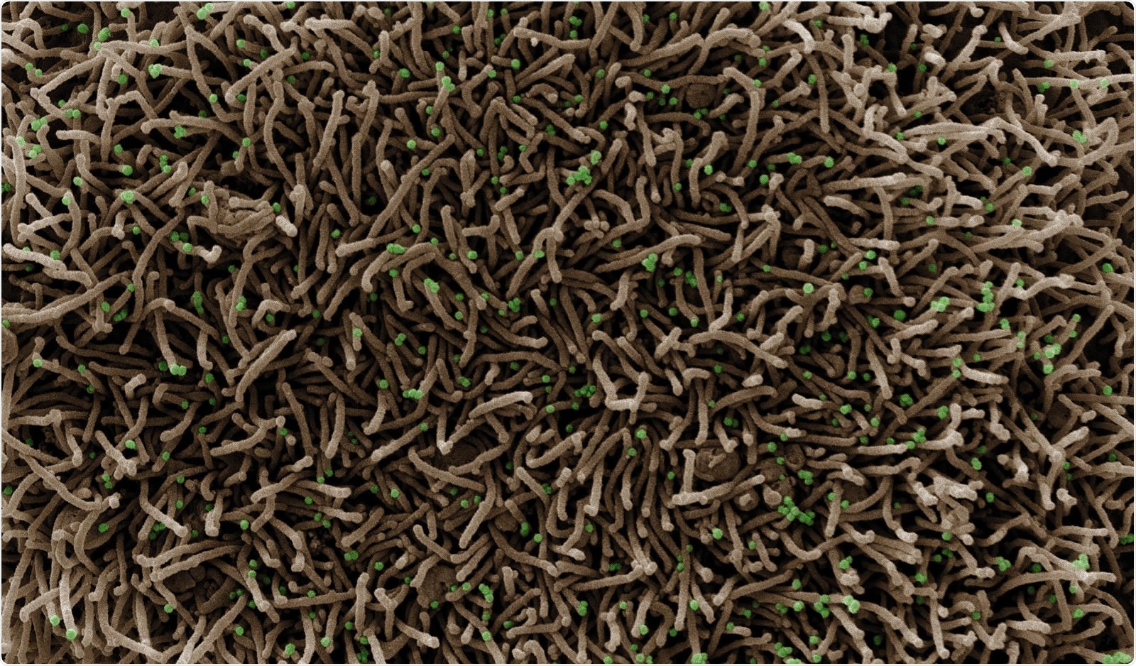 A CCL-81 cell (tan) infected with SARS-CoV-2 virus particles, which are the small spherical structures (green). The string-like protrusions extending from the cell are cell projections or pseudopodium, whose primary purposes are cell mobility and ingestion of nutrients. Image captured at the NIAID Integrated Research Facility (IRF) in Fort Detrick, Maryland. Credit: NIAID