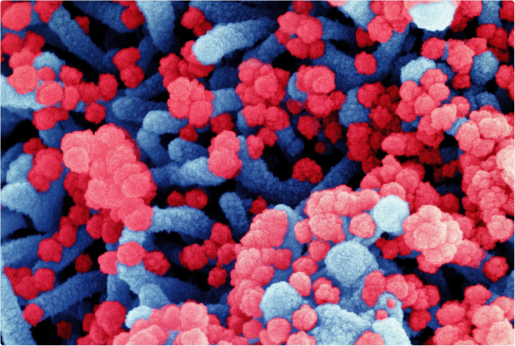 Study: Preliminary Evidence on Long COVID in children. Image Credit: NIAID