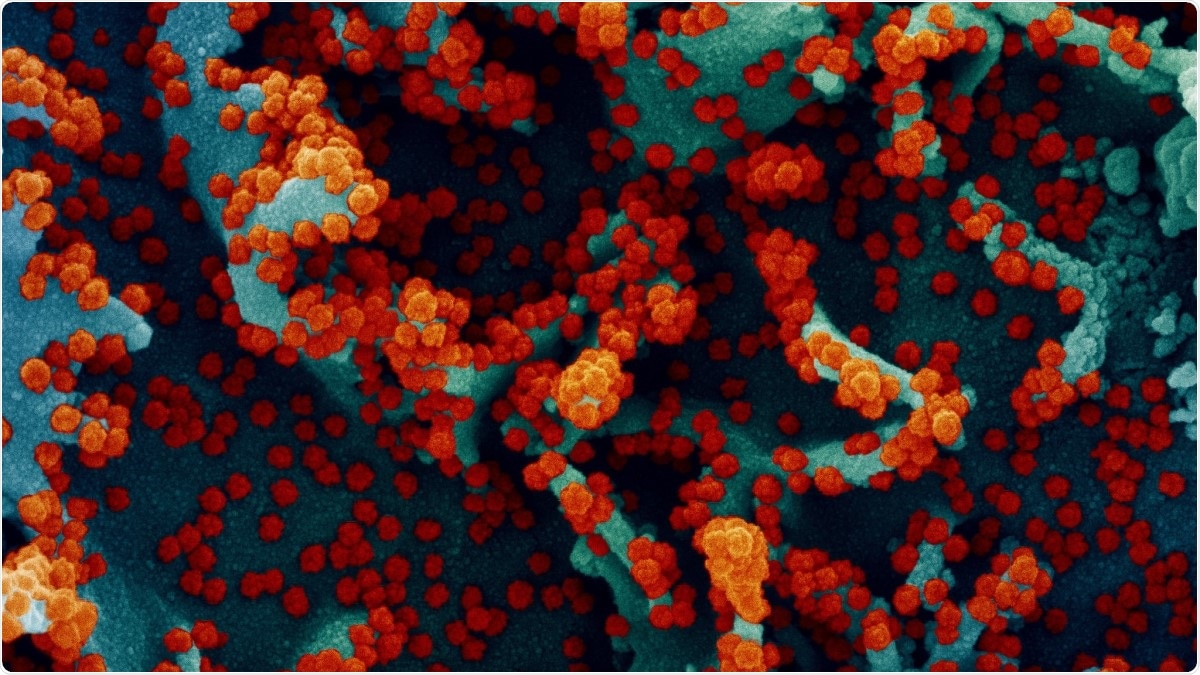 Study: Association of CXCR6 with COVID-19 severity: Delineating the host genetic factors in transcriptomic regulation. Image Credit: / Flickr