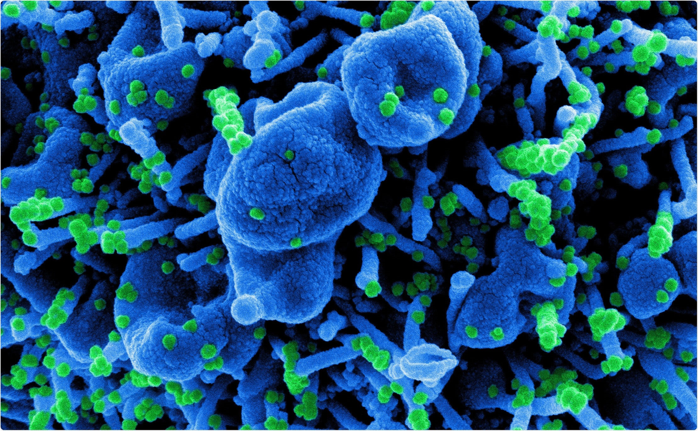 Study: Single Dose Administration, And The Influence Of The Timing Of The Booster Dose On Immunogenicity and Efficacy Of ChAdOx1 nCoV-19 (AZD1222) Vaccine. Image Credit: NIAID