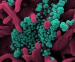 SARS-CoV-2 variants of concern drive up infections by 15-40 percent in Germany