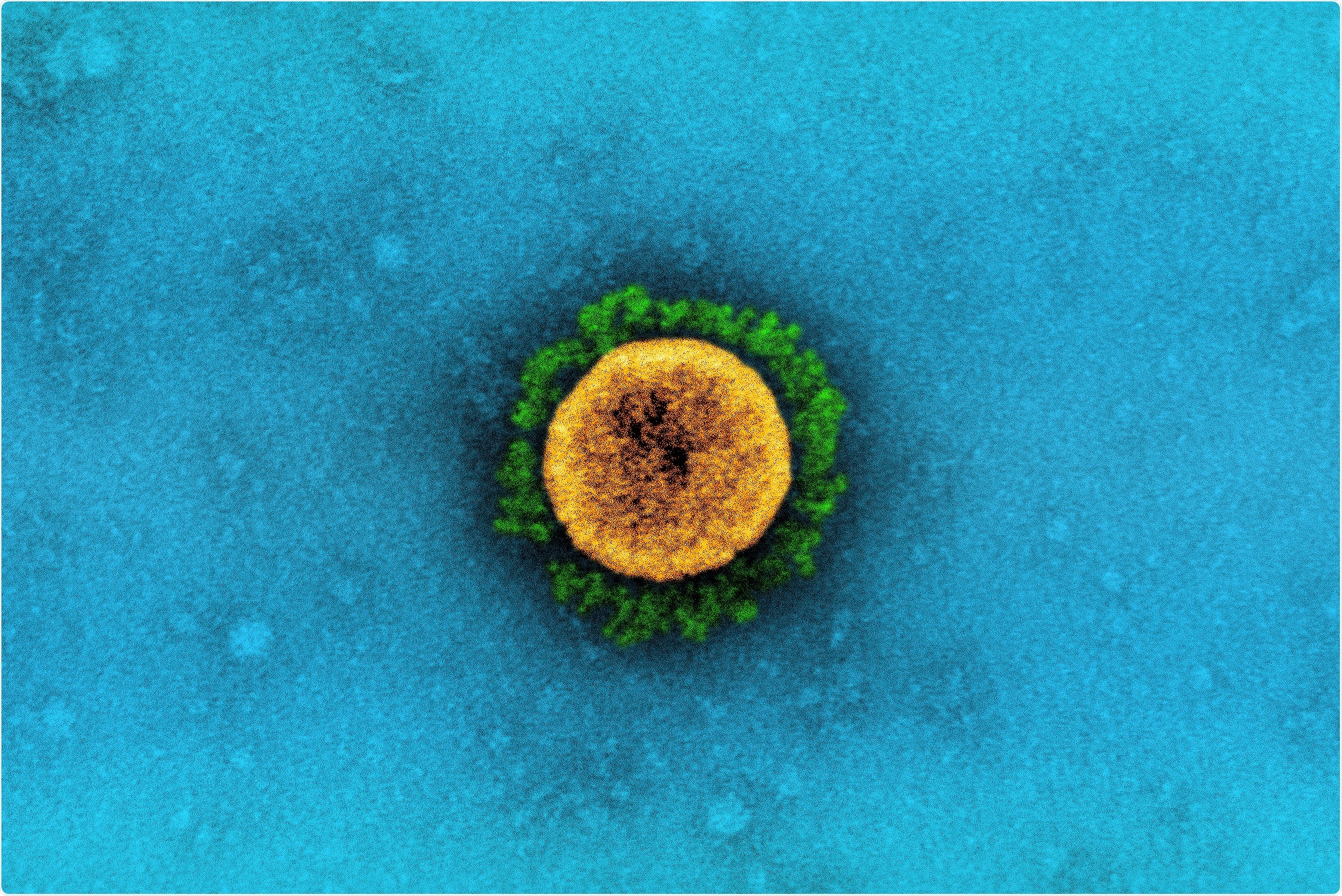 Study: FDA-authorized COVID-19 vaccines are effective per real-world evidence synthesized across a multi-state health system. Image Credit: NIAID