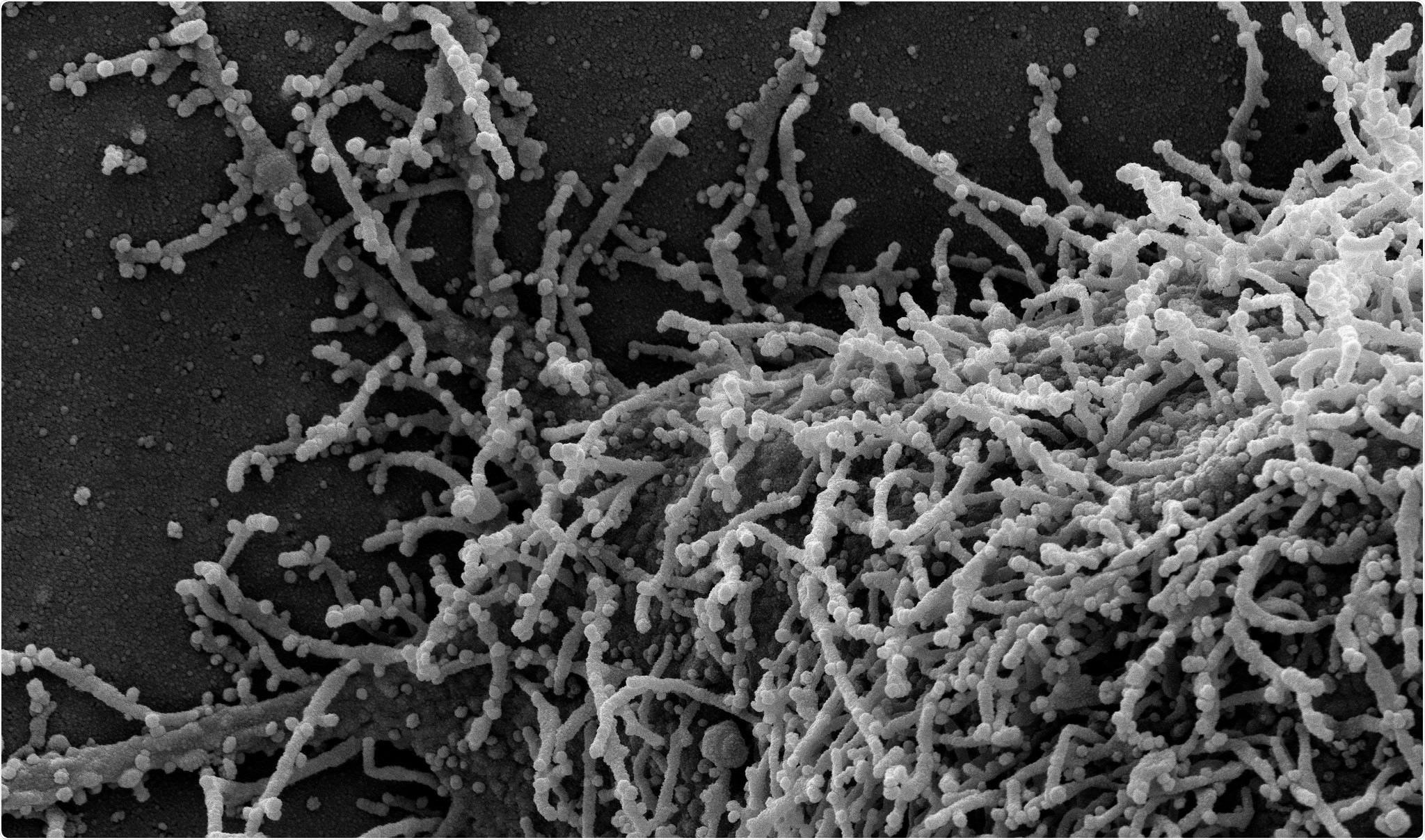 Study: Vaccine escape in a heterogeneous population: insights for SARS-CoV-2 from a simple model. Image Credit: NIAID