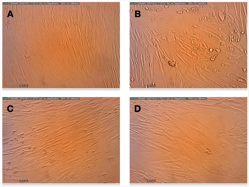 Effects of terpenes and CBD applied post-infection on the replication and cytopathic effect of HCoV-229E in MRC-5 cells. (A) Healthy MRC-5 cells, (B) MRC-5 cells at 72 h after infection with HCoV-229E, (C) MRC-5 cells that were pretreated with terpenes, photographed 72 h after infection with HCoV-229E and (D) MRC-5 cells that were pretreated with terpenes and CBD, photographed 72 h after infection with HCoV- 229E.