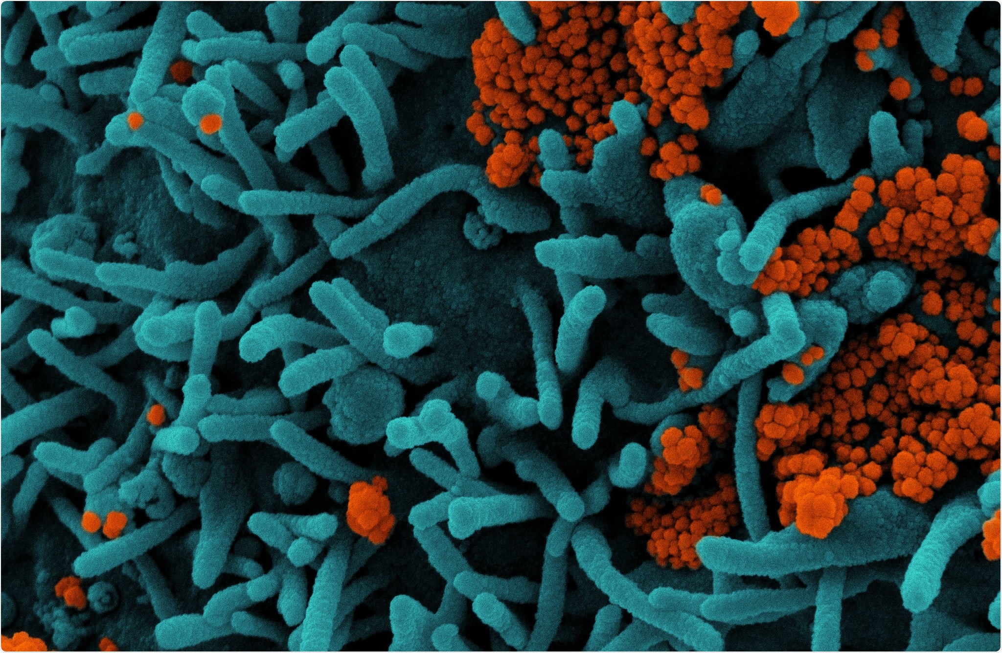 Study: CVnCoV protects human ACE2 transgenic mice from ancestral B BavPat1 and emerging B.1.351 SARS-CoV-2. Image Credit: NIAID