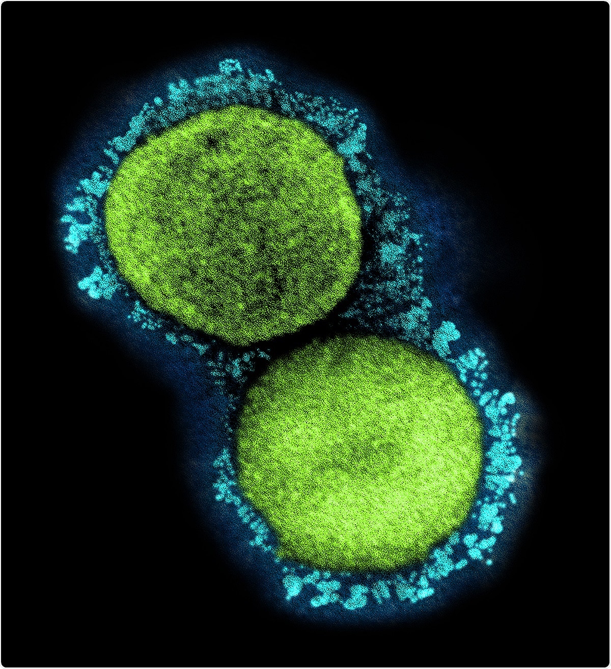 Transmission electron micrograph of SARS-CoV-2 virus particles (UK B.1.1.7 variant), isolated from a patient sample and cultivated in cell culture. Image captured at the NIAID Integrated Research Facility (IRF) in Fort Detrick, Maryland. Credit: NIAID