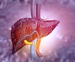 Liver Cancer Treatment