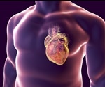 What is Myocarditis?