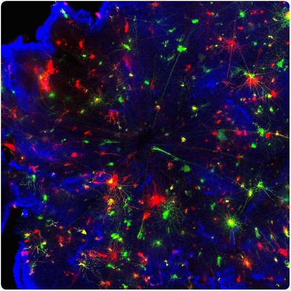 Researchers examine if a naturally occurring protein can be used to prevent sight loss from glaucoma