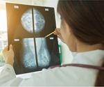 Targeting MCL-1 protein could pave way to new treatments for breast cancer
