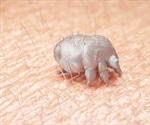 Scabies Symptoms