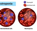 Neutropenia Diagnosis