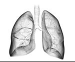 Idiopathic Pulmonary Fibrosis Triggers