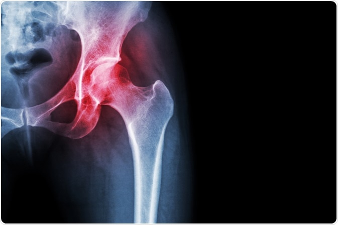 Image Credit: Puwadol Jaturawutthichai / Shutterstock