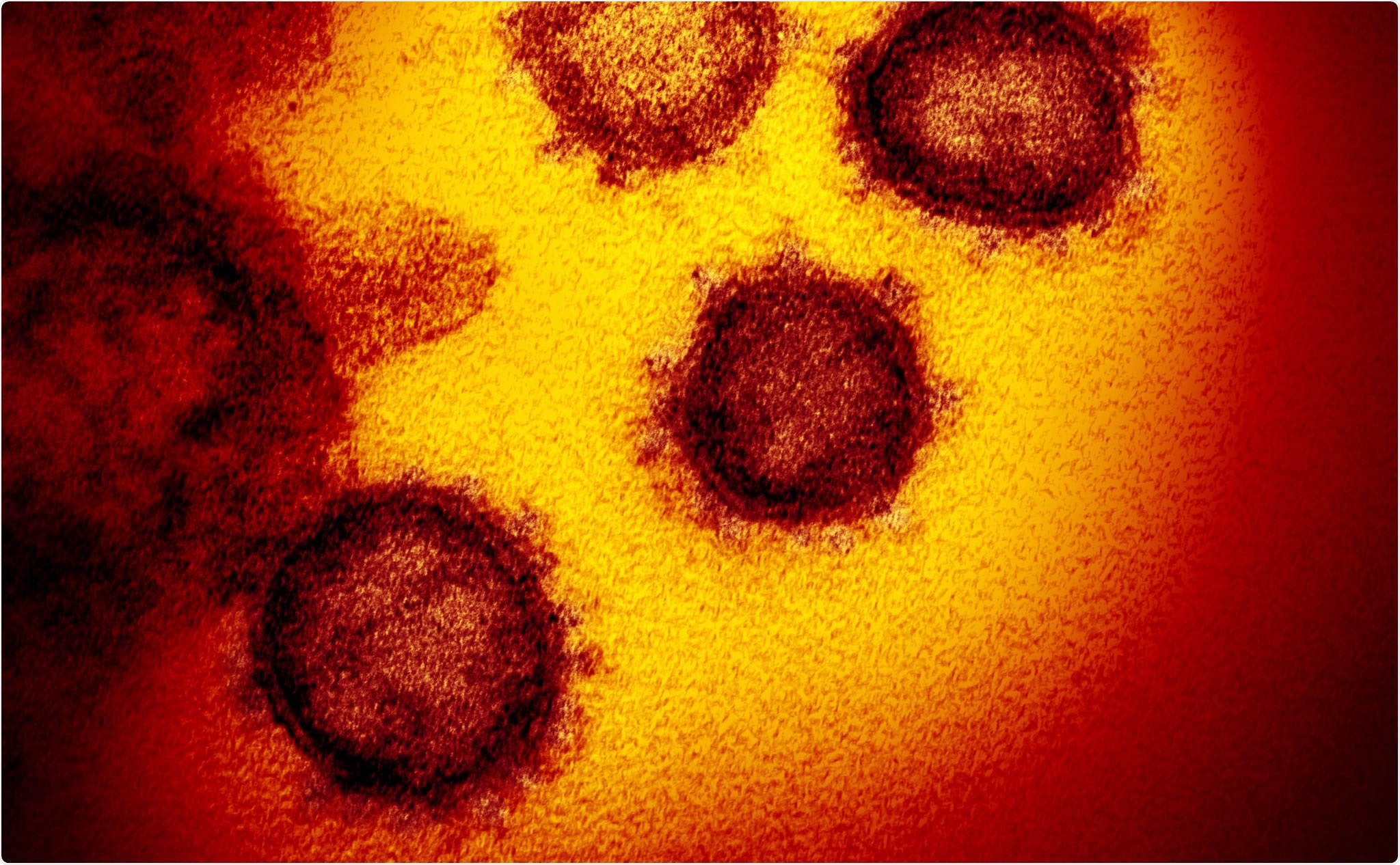 Study: Association between oral anticoagulants and COVID-19 related outcomes: two cohort studies. Image Credit: NIAID