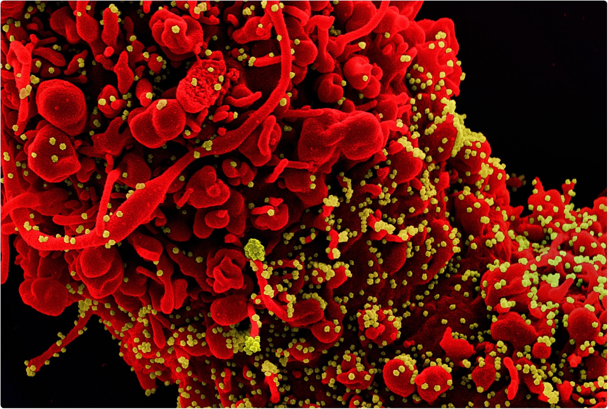 Study: Reverse vaccinology approach to design a novel multi-epitope vaccine candidate against COVID-19: an in silico study. Image Credit: NIAID