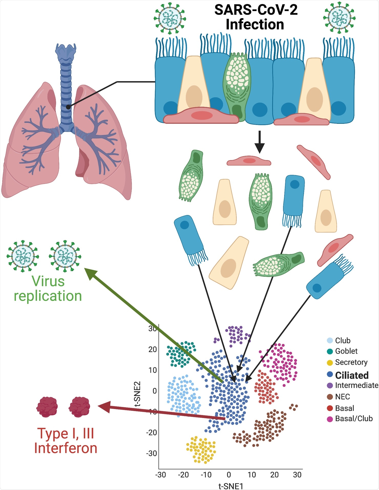 Single-cell resolution of SARS-CoV-2 infection. Primary cultures of well-differentiated bronchial epithelial cells, grown on permeable supports at ALIs, are infected with SARS-CoV-2, then separated for subsequent single-cell RNA sequencing. Using t-SNE statistical methods, cells with similar transcriptome profiles are group-clustered on two-dimensional plots. Individual cells containing SARS-CoV-2 RNAs and antiviral interferon transcripts are identified within clusters. Images were created with BioRender.com. ALI, air–liquid interface; SARS-CoV-2, Severe Acute Respiratory Syndrome Coronavirus 2; t-SNE, t-distributed stochastic neighbor embedding.