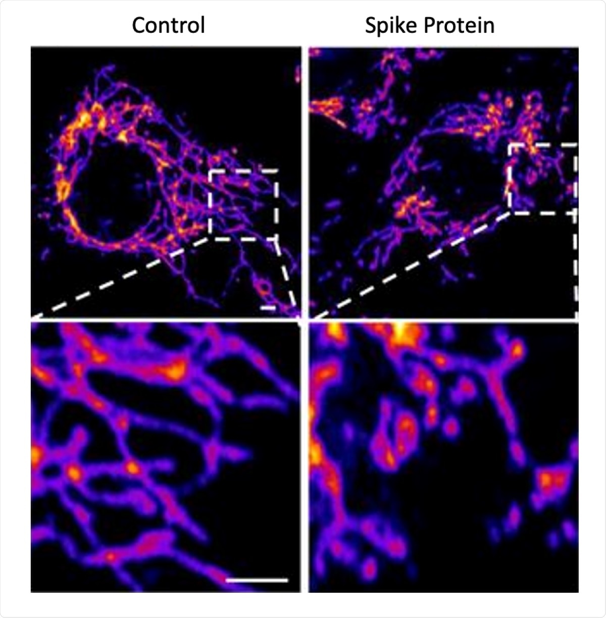 Representative images of vascular endothelial control cells (left) and cells treated with the SARS-CoV-2 Spike protein (right) show that the spike protein causes increased mitochondrial fragmentation in vascular cells.