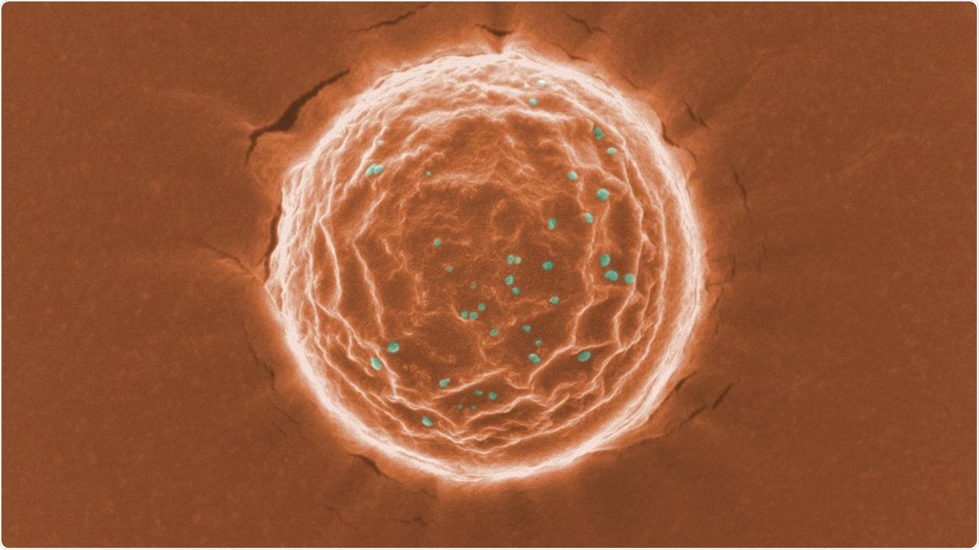 A scanning electron microscope image of a nanotrap (orange) binding a simulated SARS-CoV-2 virus (dots in green). Scientists at the University of Chicago created these nanoparticles as a potential treatment for COVID-19. Image courtesy Chen and Rosenberg et al.