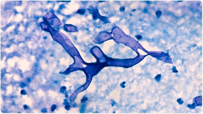 Mucormycosis Mucormycosis