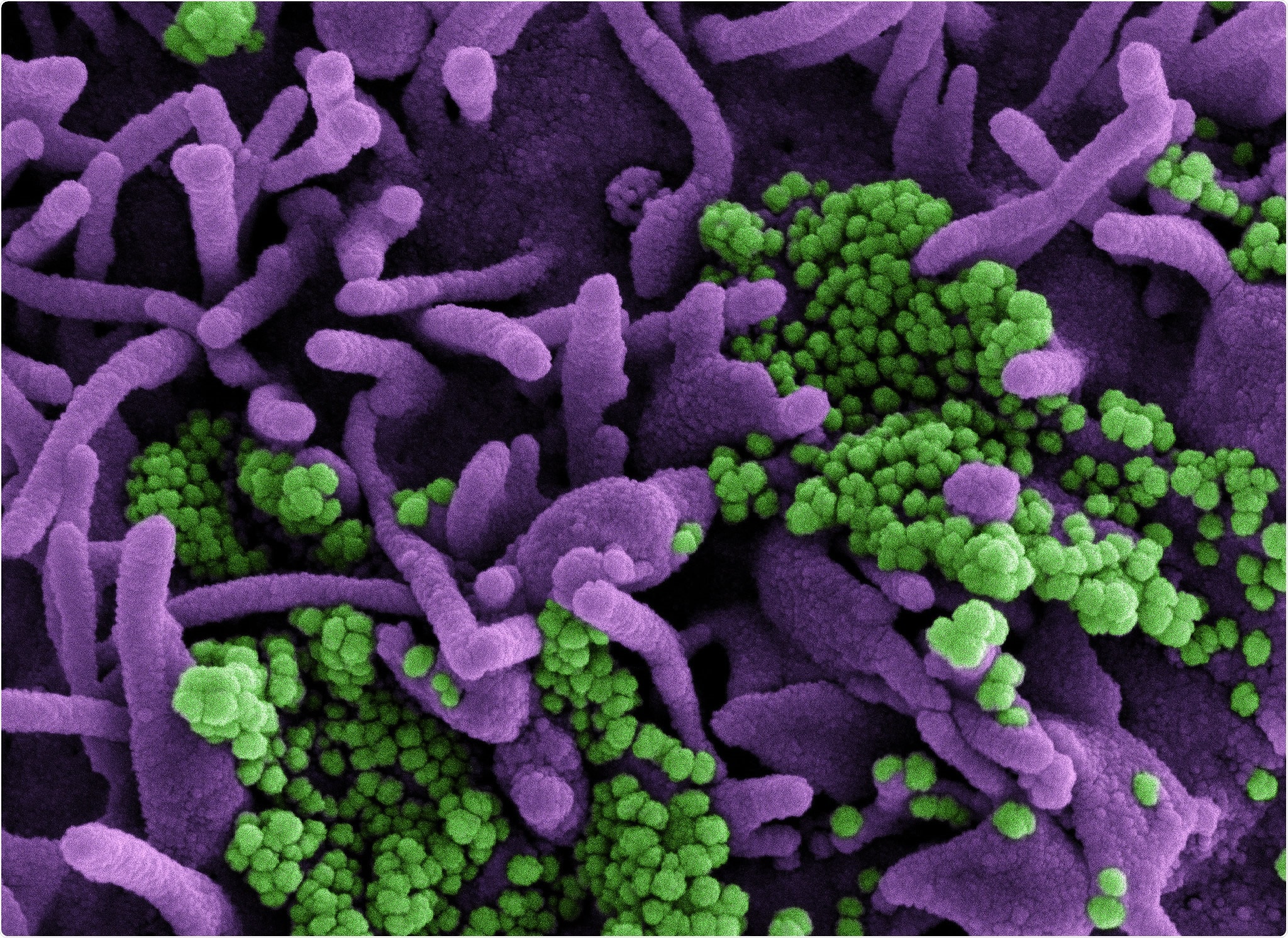 Study: Intronic regulation of SARS-CoV-2 receptor (ACE2) expression mediated by immune signaling and oxidative stress pathways. Image Credit: NIAID