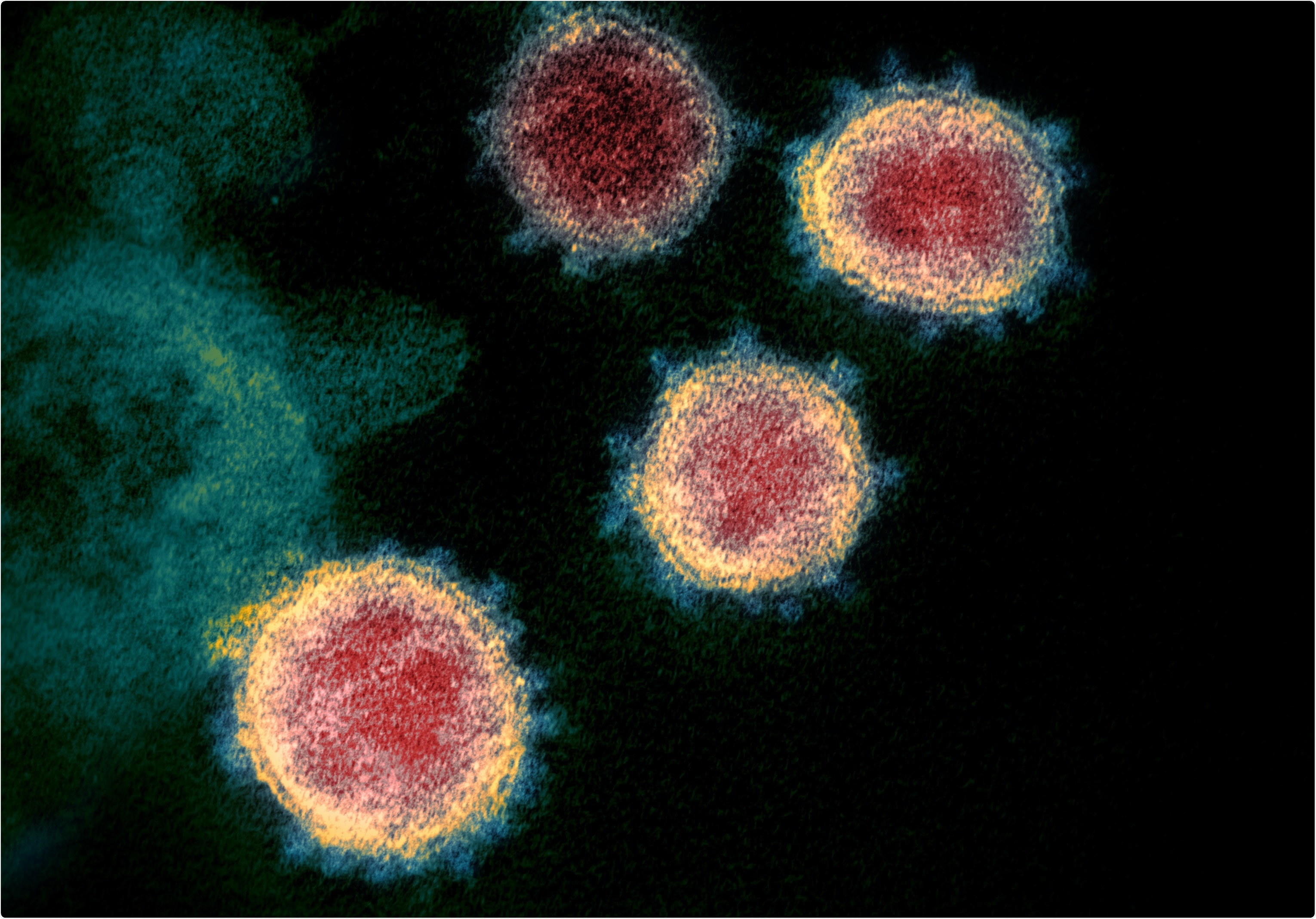 Study: Rapid displacement of SARS-CoV-2 variant B.1.1.7 by B.1.617.2 and P.1 in the United States. Image Credit: NIAID