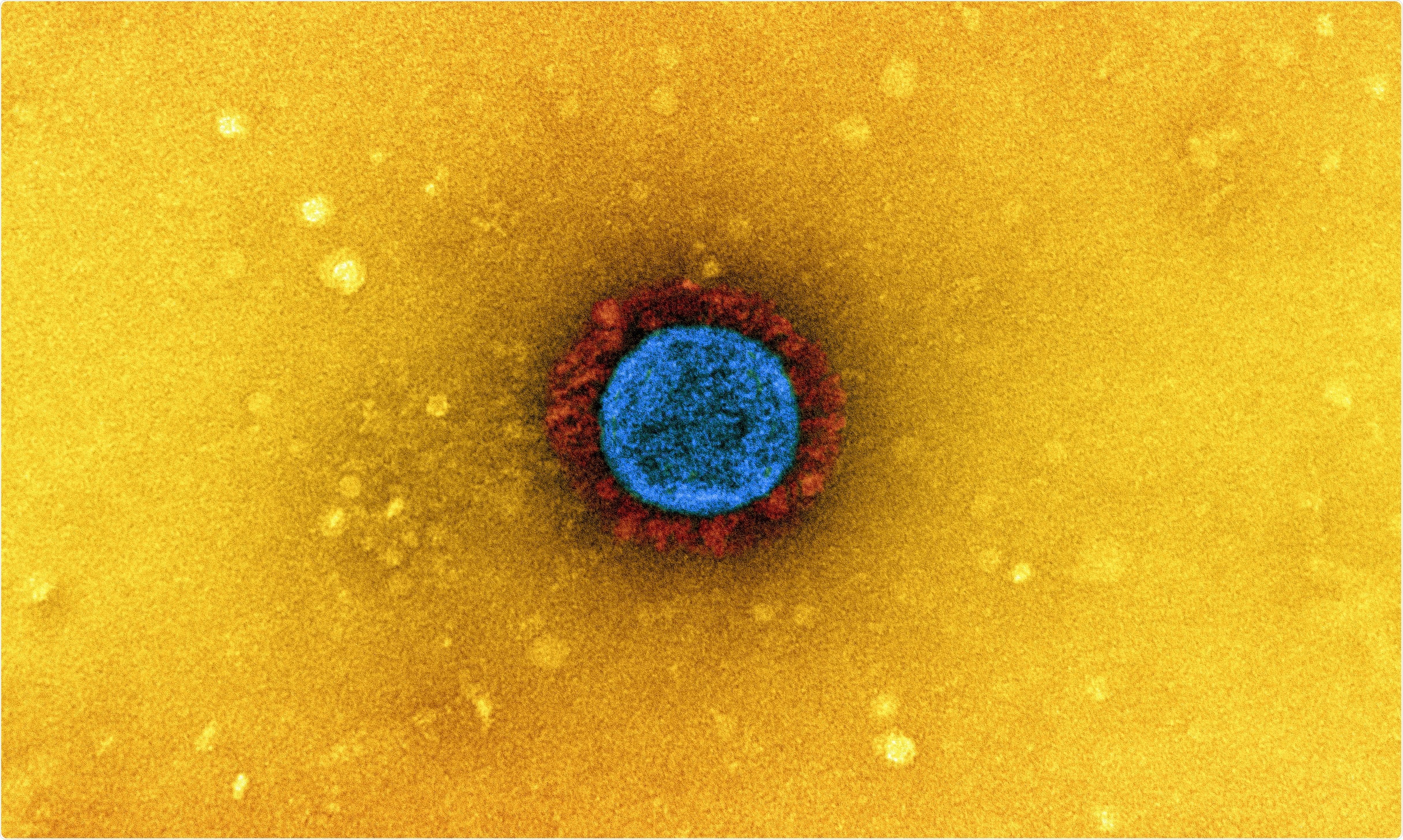 Study: Mutations in two SARS-CoV-2 variants of concern reflect two distinct strategies of antibody escape. Image Credit: NIAID