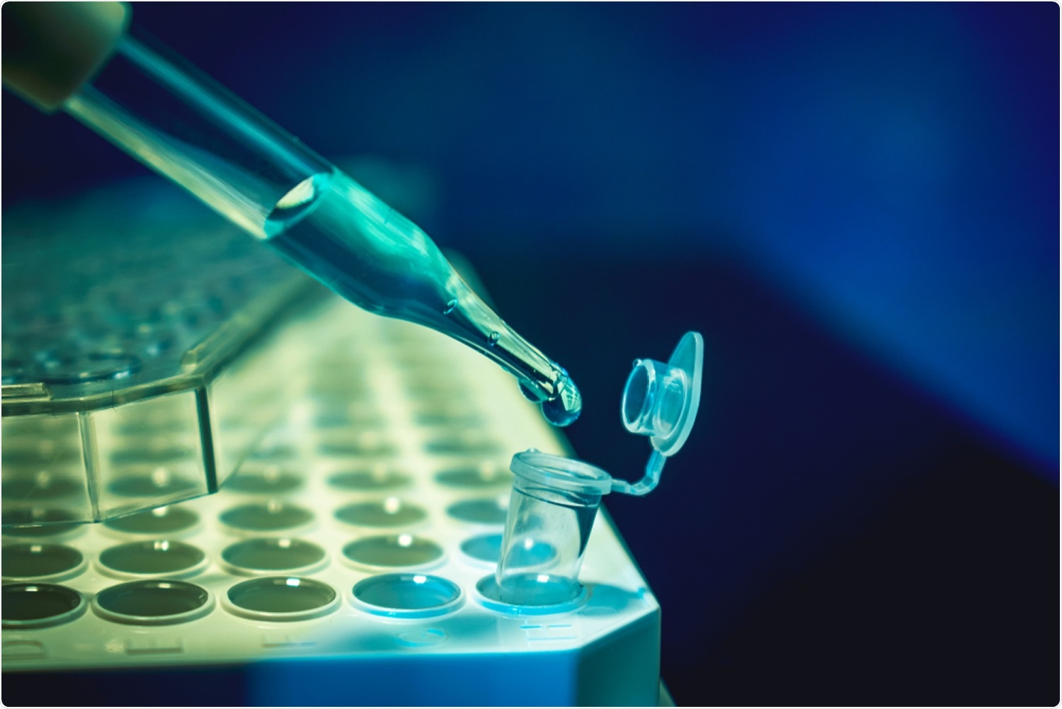 Study: CRISPRa screening with real world evidence identifies potassium channels as neuronal entry factors and druggable targets for SARS-CoV-2. Image Credit: CI Photos / Shutterstock