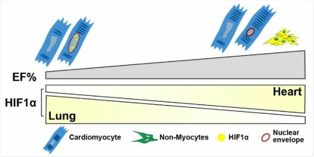 Schematic of HIF1α levels versus EF% in lung and heart. HIF1α expression is decreased in the lungs of COVID-19 patients with preserved cardiac EF but inversely, noted to be increased in the hearts of the same patients. In the preserved EF group (EF 58-63%), more HIF1α cells were detected predominantly in NCM cytoplasm (yellow shade). In low EF group (EF 33-43%), overall HIF1α+ cell quantity is lower whereas most HIF1α expression is detected in CM nuclei (yellow speckles). In cardiomyocytes, nuclear HIF1α appears to be protective by preserving nuclear Lamin and morphology. Myocyte nuclei that lack HIF1α expression appear to be enlarged and leaky with undetectable nuclear envelopes.
