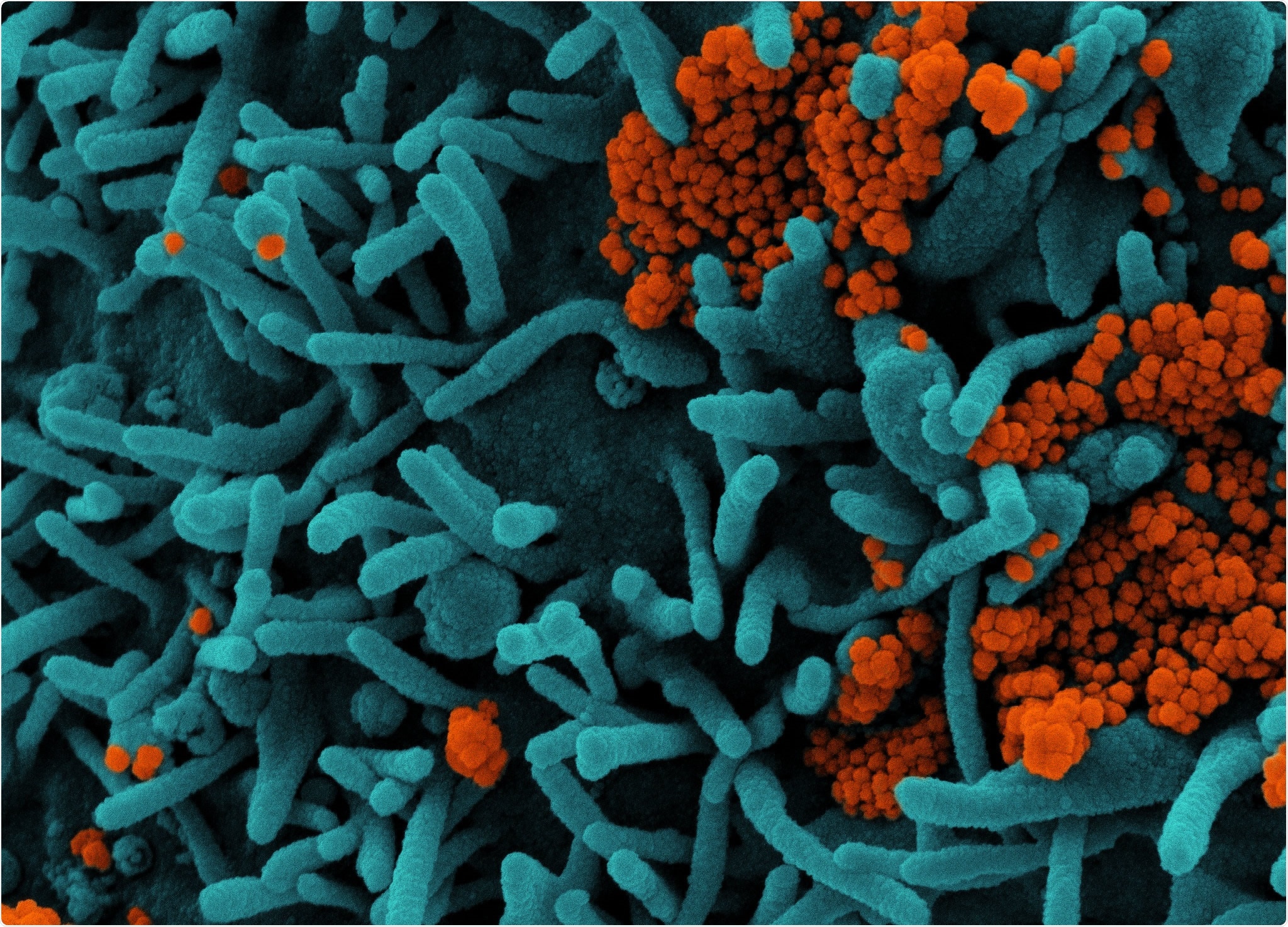 Study: Population impact of SARS-CoV-2 variants with enhanced transmissibility and/or partial immune escape. Image Credit: NIAID