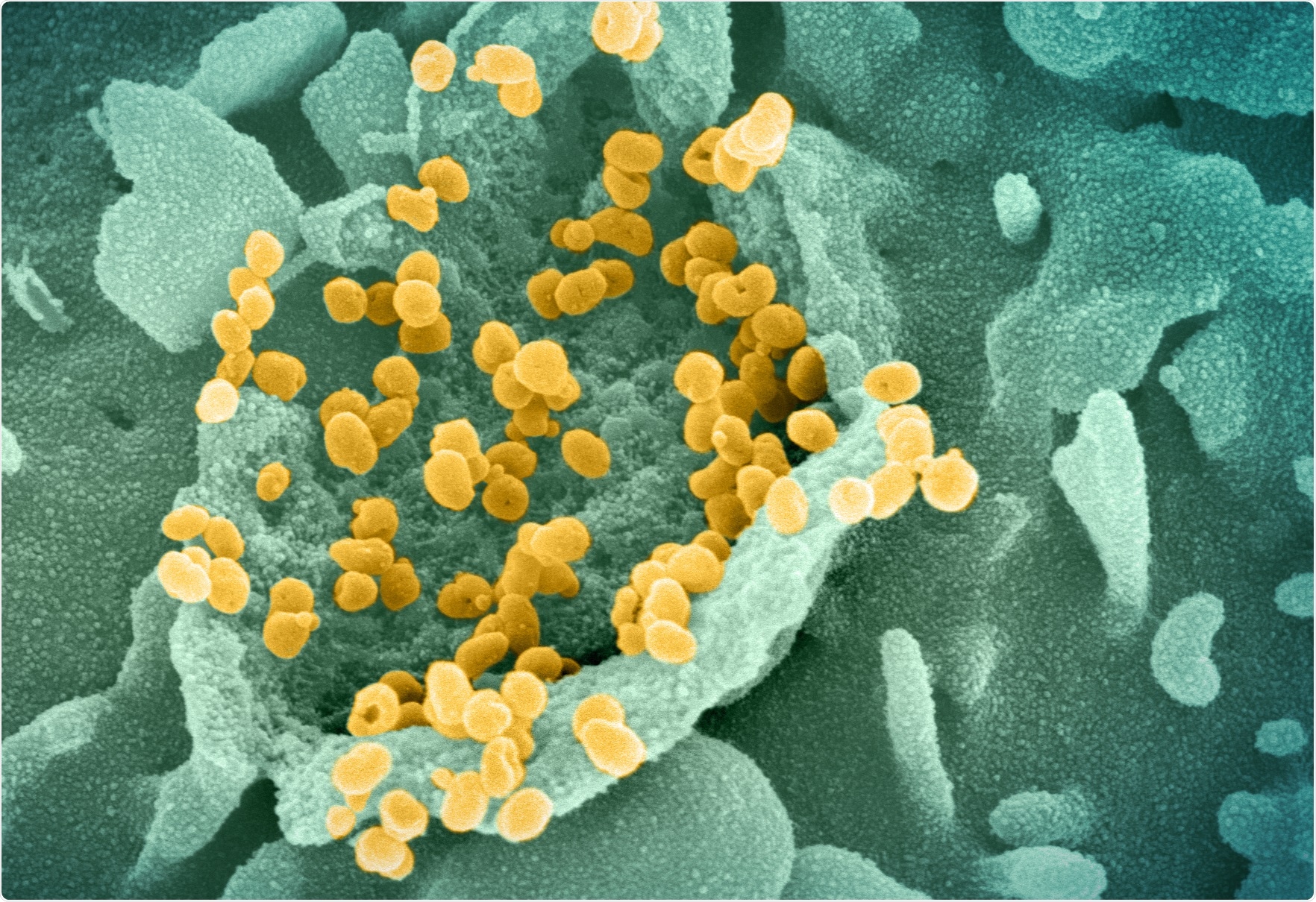 Study: Early immune responses have long-term associations with clinical, virologic, and immunologic outcomes in patients with COVID-19. Image Credit: NIAID