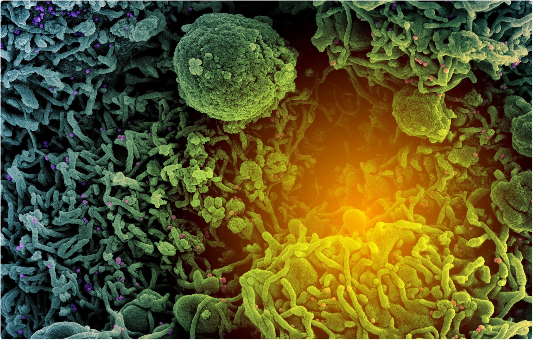 Study: Ignoring spatial heterogeneity in drivers of SARS-CoV-2 transmission in the US will impede sustained elimination. Image Credit: NIAID