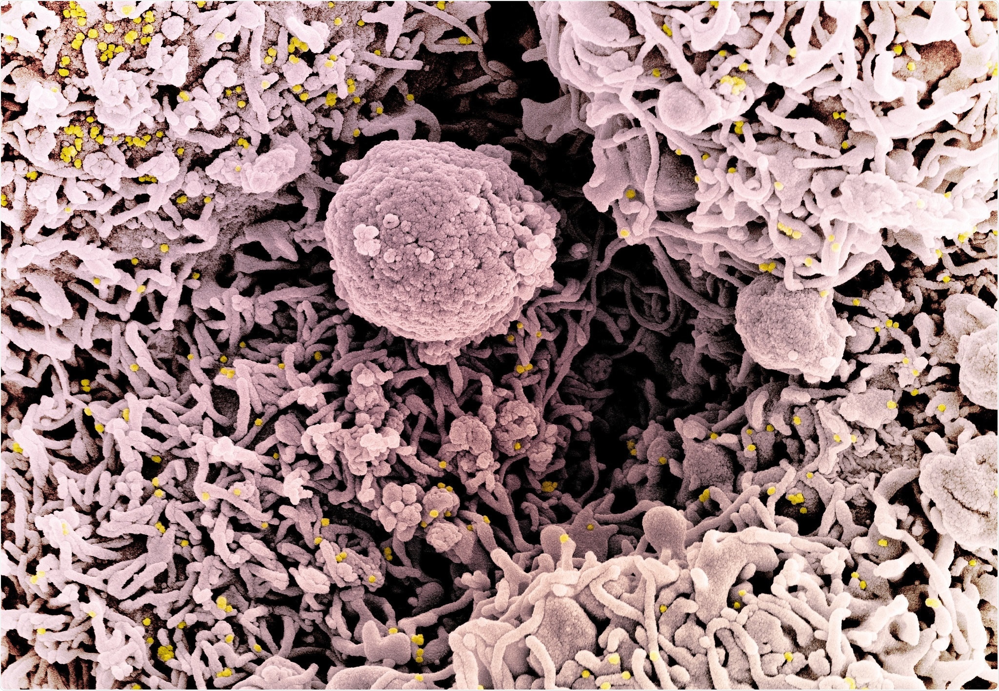 Study: Covid-19 vaccine immunogenicity in people living with HIV-1. Image Credit: NIAID