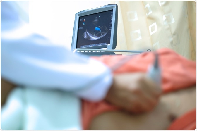 Echocardiography Echocardiography