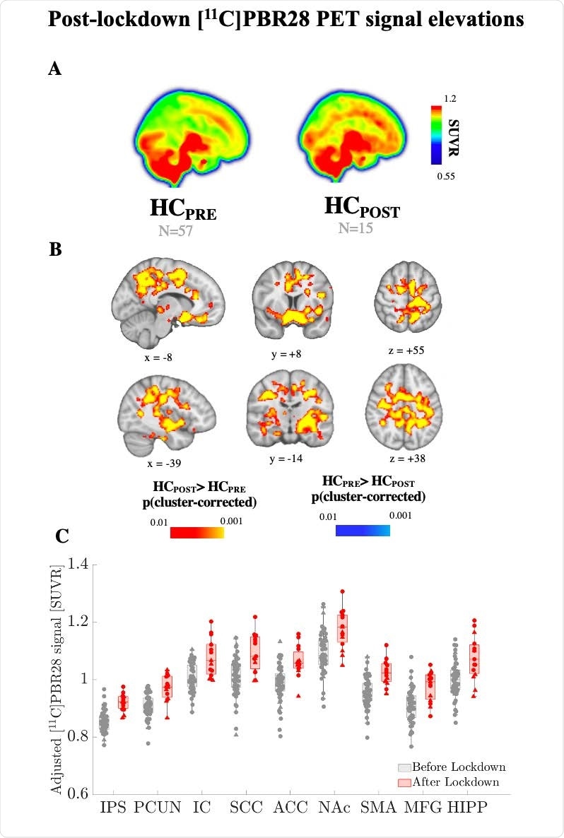 Post-lockdown [11C]PBR28 PET signal elevations in voxelwise group analyses. Areas of elevated PET [11C]PBR28 signal (SUVR) in HCPOST subjects compared to HCPRE subjects. (A) Mean images computed from 57 HCPRE and 15 HCPOST subjects are displayed as maximum intensity projections. (B) Significant cluster from the HCPOST/>HCPRE voxel-wise contrast is shown in a red–yellow color scale. There were no significant regions for the HCPRE > HCPOST contrast. (C) Visualization of mean [11C]PBR28 SUVR extracted from sub-portions of the cluster statistically significant in A.