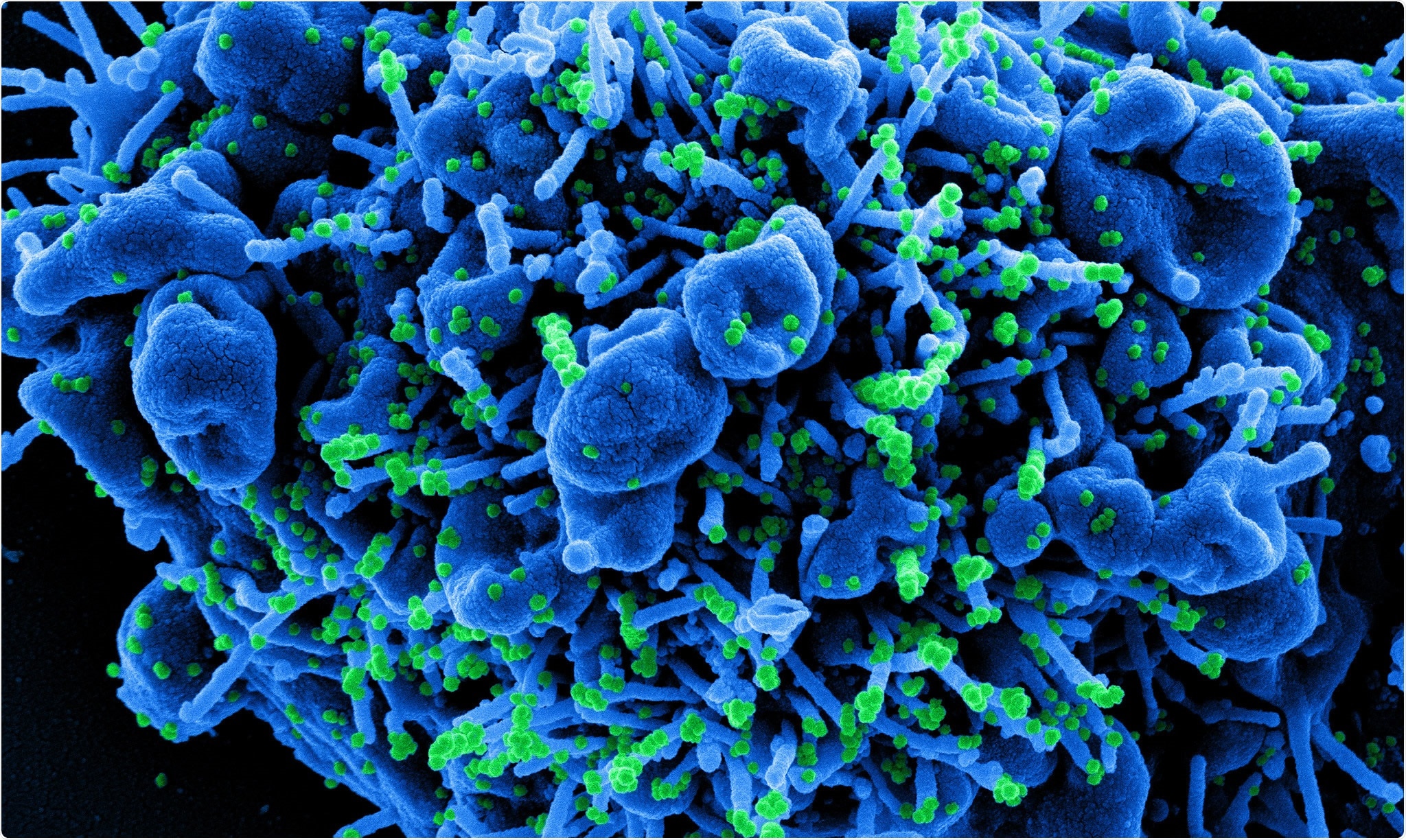 Study: Health impact and cost of COVID-19 prophylaxis with monoclonal antibodies. Image Credit: NIAID